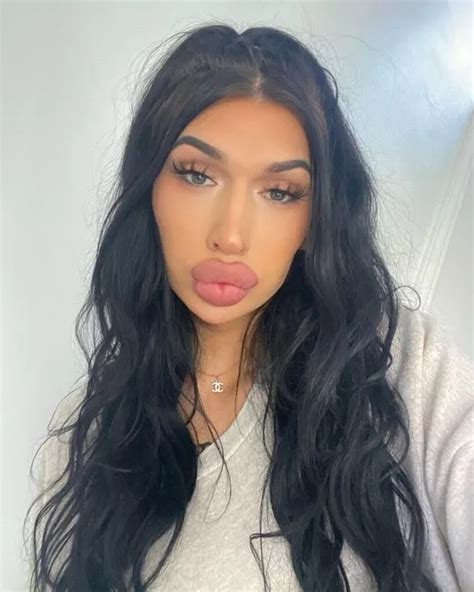 I spent £1,000 on lip fillers – my sugar daddy pays and I feel so .